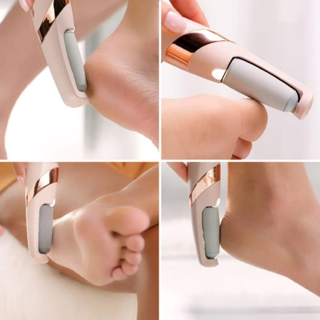 Electric Foot Callus Remover – Rechargeable Pedicure File for Dead Skin, Cracked Heels & Smooth Feet